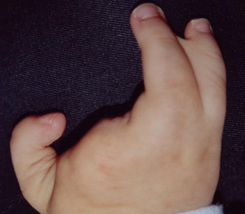 北醫生殖突破單基因胚胎診斷 陳啟煌醫師