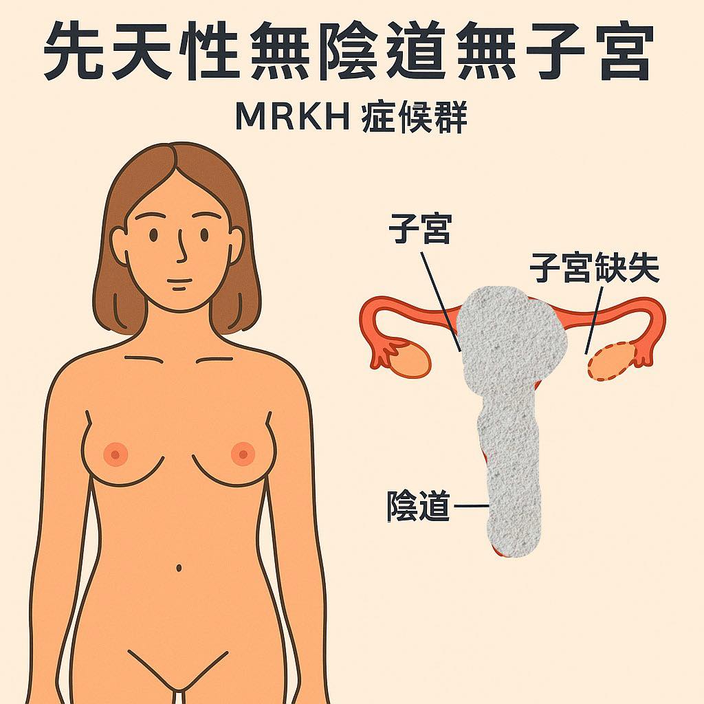 試管嬰兒極端案例-這本是考試才見到的病，罕見！#北醫陳啟煌醫師