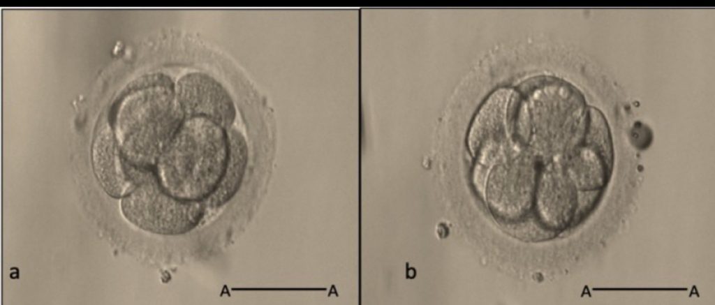 胚胎品質評估如何決定D3或D5移植