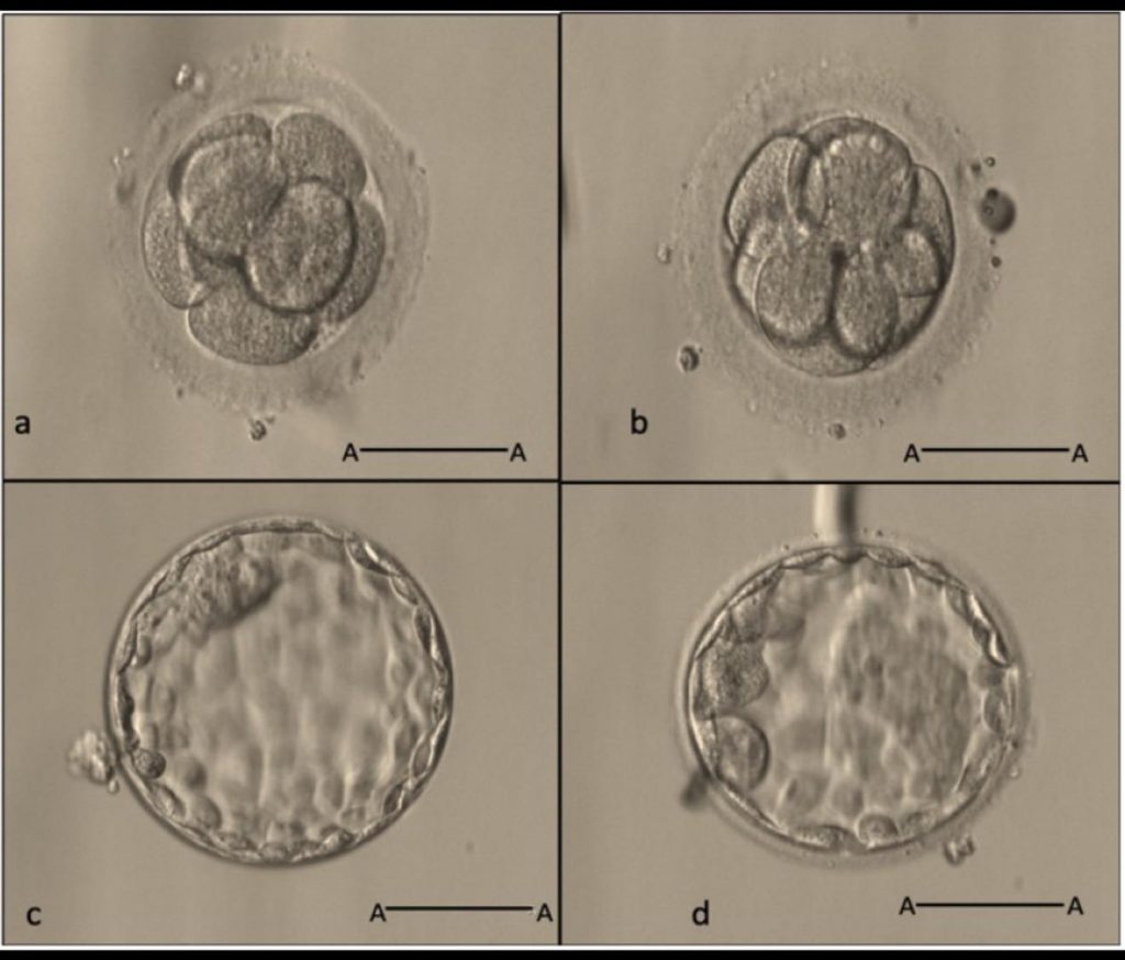 #北醫生殖中心 的經驗談