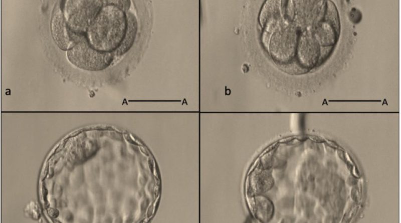 #北醫生殖中心 的經驗談