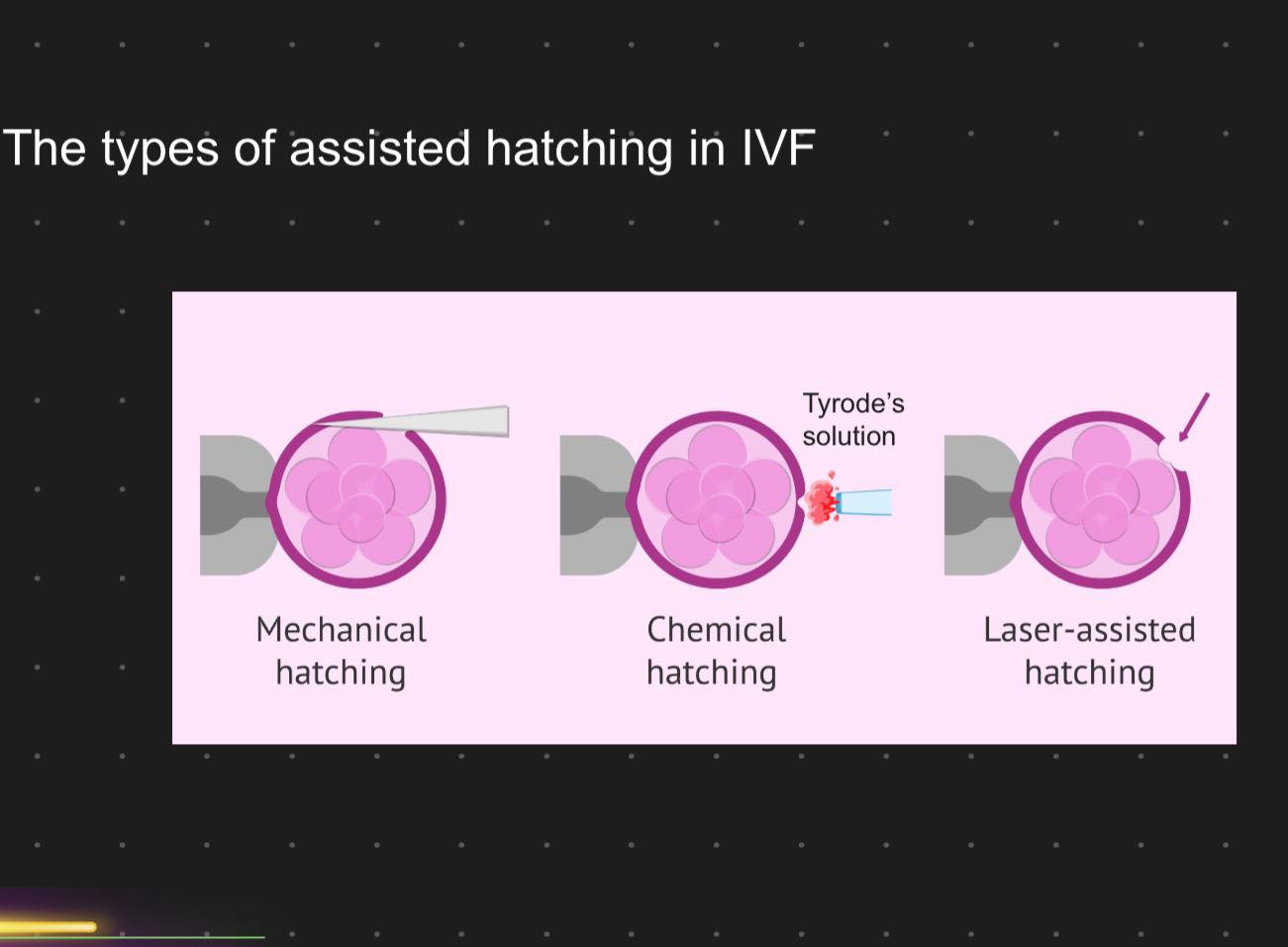 輔助胚胎孵化(Assisted Hatching)之於著床 #北醫陳啟煌